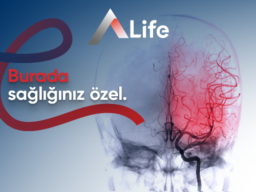 Beyin Anjiyosu (Beyin Anjiyografi)